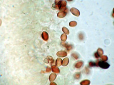 foto de Esporas dextrinoides de Leucoagaricus