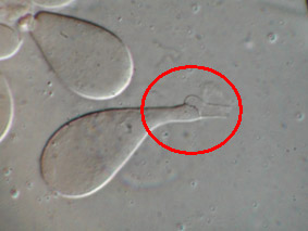 foto de Queilocistidio con fíbula basal de Chlorophyllum brunneum