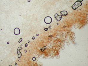 foto de Pelis tipo epitelio de Cystoderma