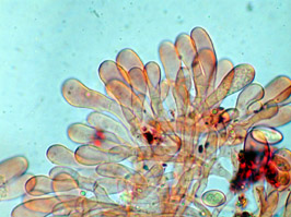 foto de Queilocistidios de Macrolepiota